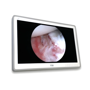 SKIP TO THE BEGINNING OF THE IMAGES GALLERY 4K UHD SURGICAL LCD MONITOR by Foreseeson Custom Displays/OPHIT/FSN Medical