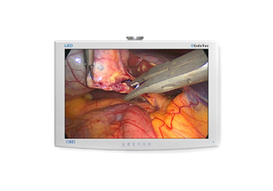 REPAIR SERVICE FOR NDS ENDOVUE DISPLAY REPAIR SERVICE FOR NDS ENDOVUE DISPLAY