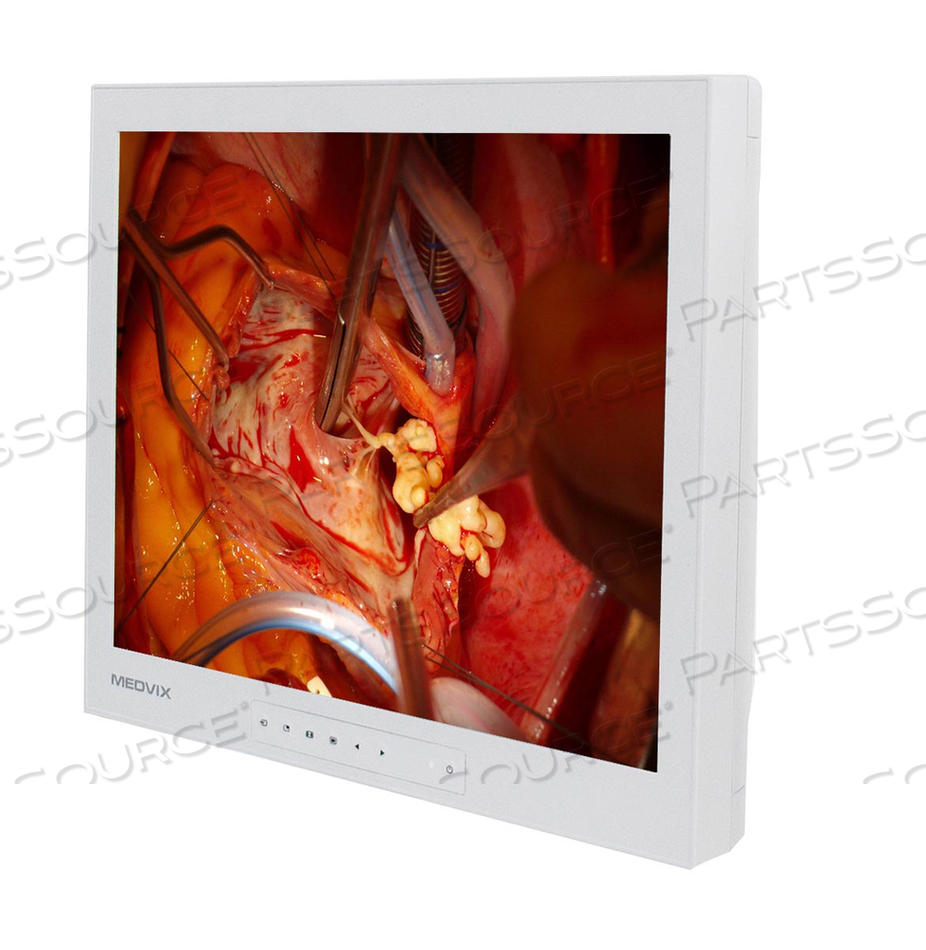 SURGICAL DISPLAY MONITOR, 5:4 ASPECT RATIO, 900:1 CONTRAST RATIO, 19 IN VIEWABLE IMAGE, 47 TO 63 HZ, 1280 X 1024 RESOLUTION, 35 W, 100 TO 25 