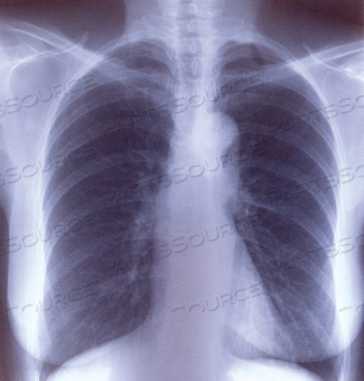 CLEAR CHOICE™ PERFORMANCE X-RAY FILM (100 PER BOX) by McKesson