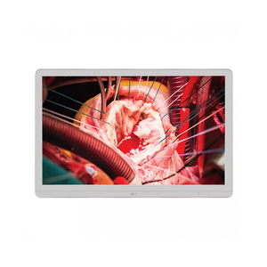 MONITOR by Foreseeson Custom Displays/OPHIT/FSN Medical MONITOR by Foreseeson Custom Displays/OPHIT/FSN Medical