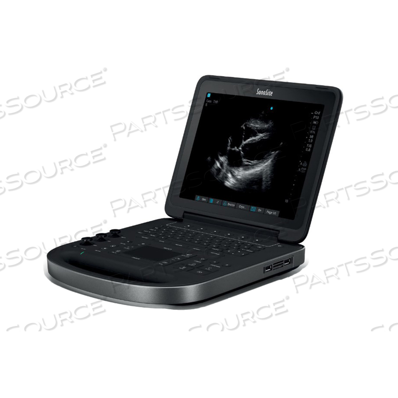 REPAIR - SONOSITE TITAN SERIES ULTRASOUND SYSTEM REPAIR - SONOSITE TITAN SERIES ULTRASOUND SYSTEM