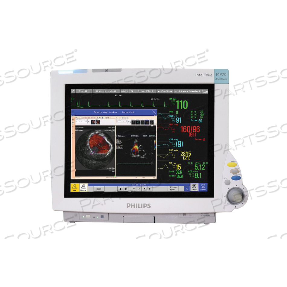 INTELLIVUE MP60 PATIENT MONITOR, 4 WAVES, SOFTWARE ANESTHESIA-H, BACKUP BATTERY OPTION 