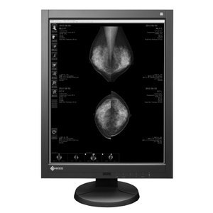 RADIFORCE 5MP MONO SINGLE HEAD BUNDLE WITH 1X GX540 DISPLAY AND 1X NVIDIA QUADRO K2000 VIDEO CARD by Eizo Inc.