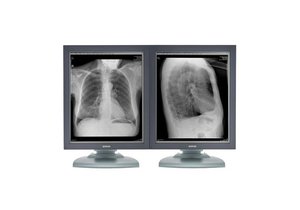 MEDICAL DIAGNOSTIC RADIOLOGY MONITOR, LCD, TFT PANEL, 850:1 CONTRAST RATIO, 21.3 IN VIEWABLE IMAGE, 1600 X 1200 RESOLUTION, GRAYSCALE by Hologic, Inc.