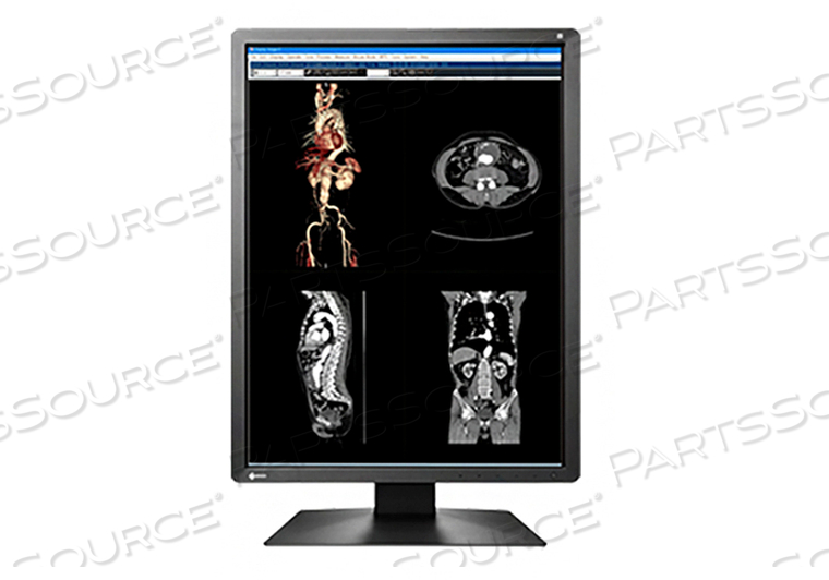 MX-SERIES 21" COLOR TFT LCD LED, DICOM CALIBRATION, BLACK, INTEGRATED FRONT SENSOR(IFS), 1600X1200, DIGITAL DVI- D INPUT AND DISPLAYPORT 1.2 WITH DAISY CHAINING, 500 CD/M2, 1500:1 CONTRAST RATIO, 178X178 VIEWING ANGLES, 20 MS RESPONSE TIME, RADICS LE BUNDLED, HEIGHT ADJUSTAB by Eizo Inc. MX-SERIES 21" COLOR TFT LCD LED, DICOM CALIBRATION, BLACK, INTEGRATED FRONT SENSOR(IFS), 1600X1200, DIGITAL DVI- D INPUT AND DISPLAYPORT 1.2 WITH DAISY CHAINING, 500 CD/M2, 1500:1 CONTRAST RATIO, 178X178 VIEWING ANGLES, 20 MS RESPONSE TIME, RADICS LE BUNDLED, HEIGHT ADJUSTAB by Eizo Inc.