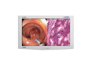 SURGICAL MONITOR DISPLAY, 24 VDC, 60 W, 1400:1 CONTRAST RATIO, 1920 X 1080, 178 DEG VIEWING ANGLE by NDS Surgical Imaging