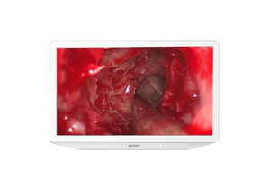 HD SURGICAL MONITOR, DR PANEL, 16:9 ASPECT RATIO, 1000:1 CONTRAST RATIO, 26 IN VIEWABLE IMAGE, 50/60 HZ, 1920 X 1080 RESOLUTION, 0.6 TO 0.3  by Karl Storz
